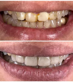orthosquare smile design Before & After Gallery