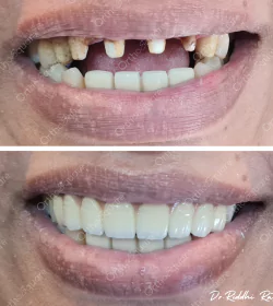 orthosquare smile design Before & After Gallery